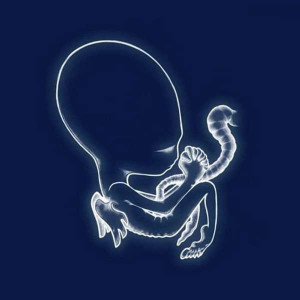 Sigur Rós - Agaetis Byrjun