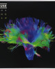 Muse - The 2nd Law Muse - The 2nd Law